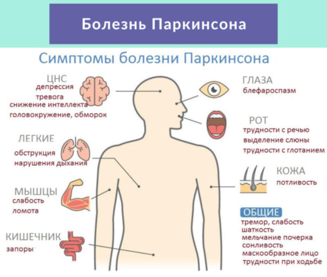 симптомы болезни Паркинсона