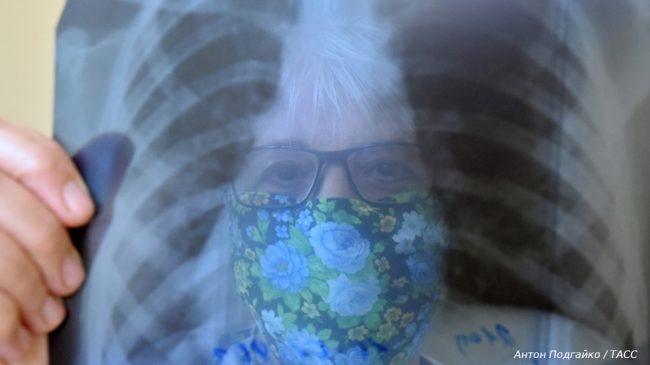 растет число случаев внебольничной пневмонии